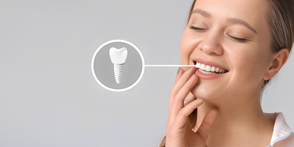 Innovative Dental Implants Techniques In Islamabad