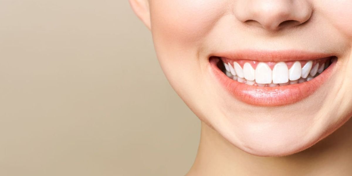 Gummy Smile Treatment in Islamabad