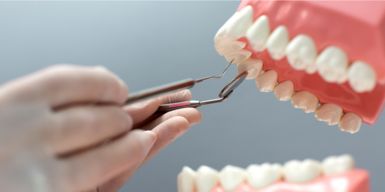 What Are The Pros And Cons Of Dental Implants?