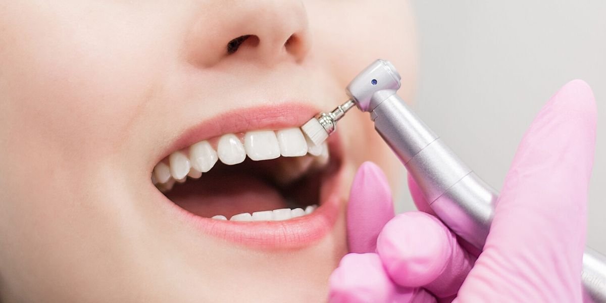 Teeth Cleaning in Rawalpindi Islamabad