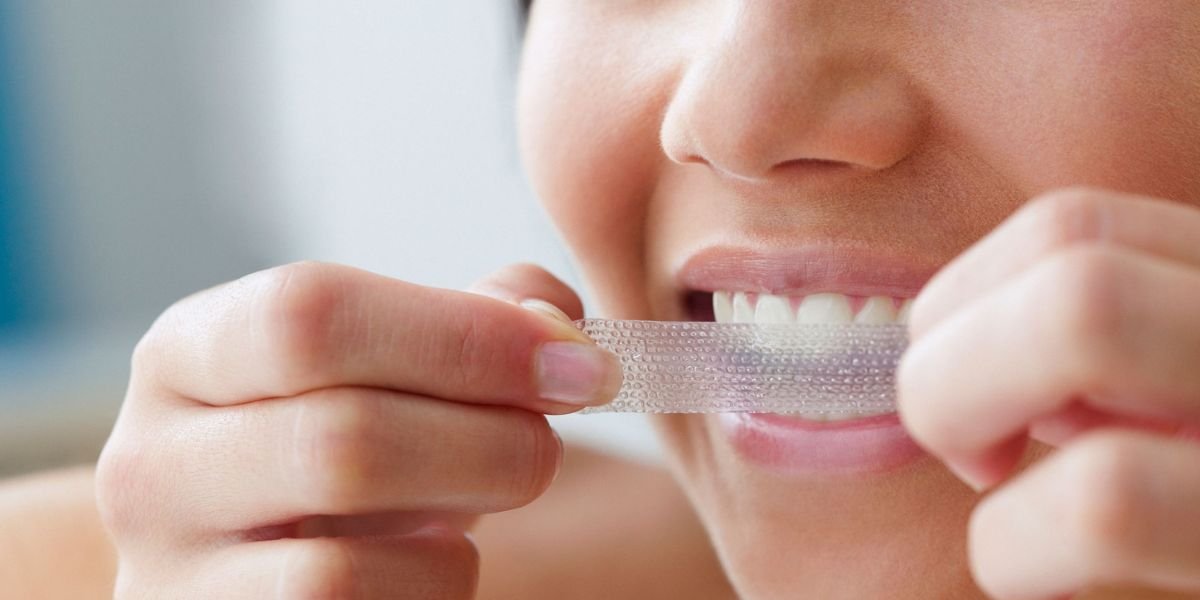 Teeth Whitening Strips in Islamabad