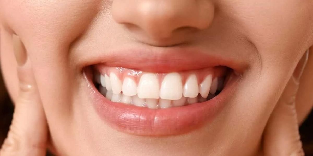 Gum Whitening Treatment in Islamabad